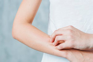 kobold blog woman scatching herself close up