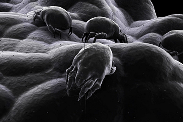 Mikroskopisch kleine Tiere: Milben